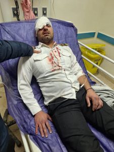 حمله همراه یک بیمار منجر به نابینایی یکی از چشمان نیروی حراست بیمارستان ۲۲ بهمن مسجدسلیمان شد