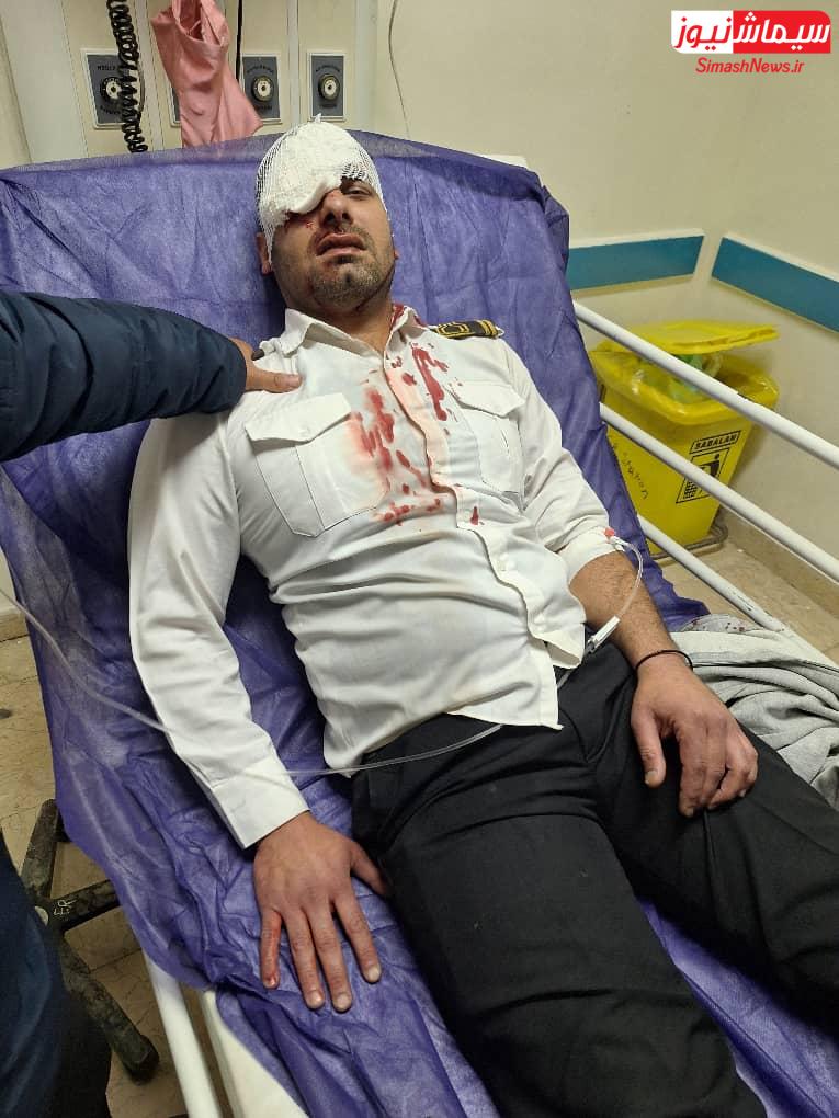 حمله همراه یک بیمار منجر به نابینایی یکی از چشمان نیروی حراست بیمارستان ۲۲ بهمن مسجدسلیمان شد